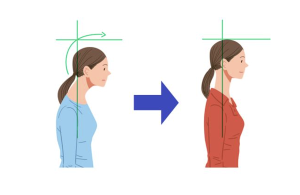 거북목과 목 통증은 어떤 관계일까?｜논문으로 보는 자세 이야기 ①